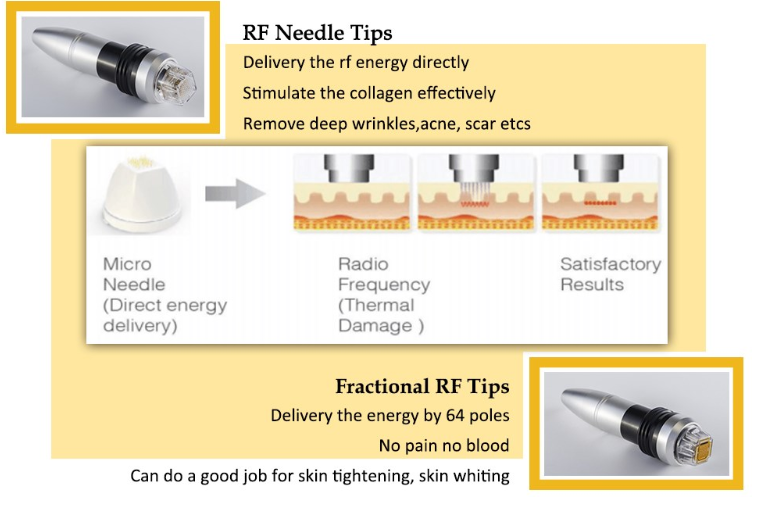 Contact Supplier Chat Now! Fractional Infini Rf Stretch Mark Radio Frequency Microneedle Machine With Two Treatment Heads Contact Supplier Chat Now! Fractional Infini Rf Stretch Mark Radio Frequency Microneedle Machine With Two Treatment Heads