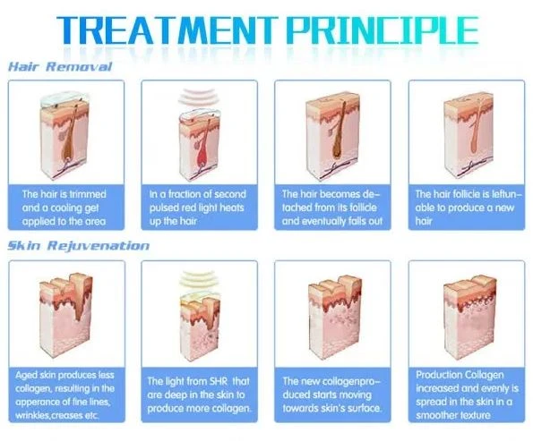 Permanent Big Spot Size 810nm Diode Laser Hair Removal Machine